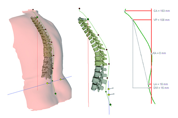 osteoporose_10x15cm.jpg