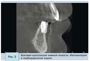 Седов-6.jpg