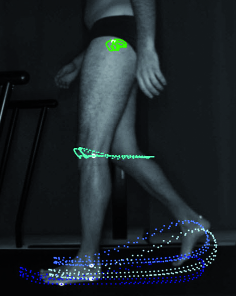 leg axis lateral_view markers.jpg