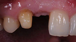RONDOflex-plus-360_Bridge2_800px.jpg