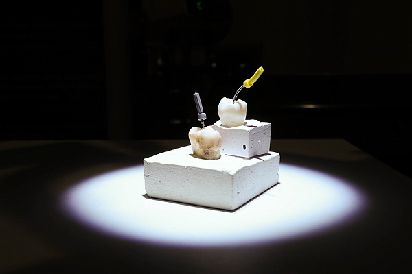 АутоЛогичная Имплантология6.jpg